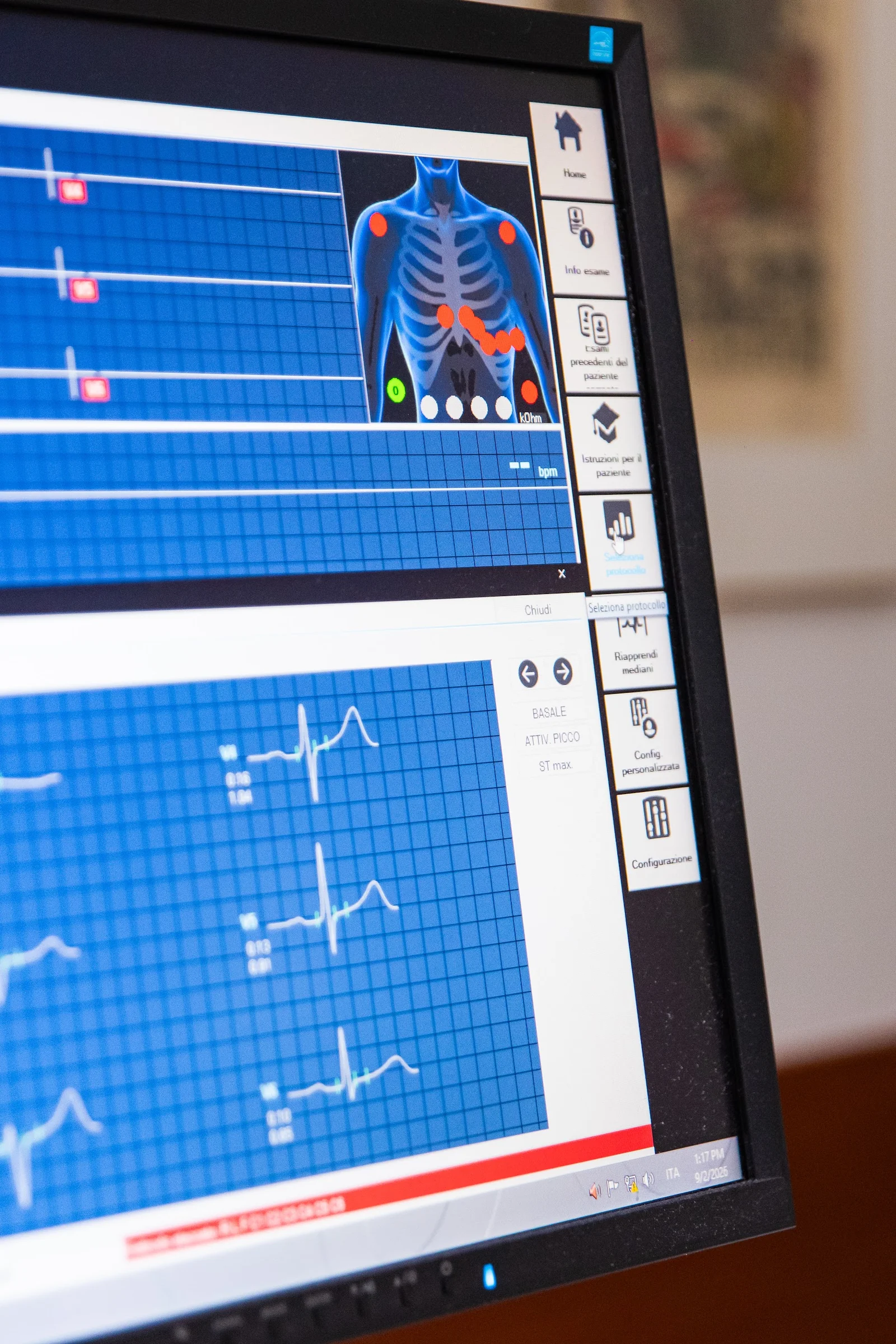 IRO Centro Diagnostico — il tracciato sul monitor